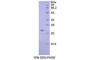 SDS-PAGE analysis of Human REXO2 Protein. (REXO2 Protéine)