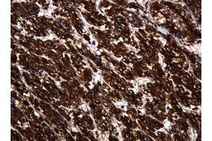 Image no. 8 for anti-Pogo Transposable Element with KRAB Domain (POGK) antibody (ABIN1500329)