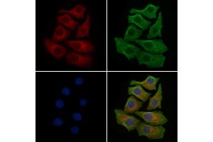 ABIN6259184 and ABIN6275514 staining HepG2 cells by IF/ICC. (SCFD1 anticorps  (C-Term))