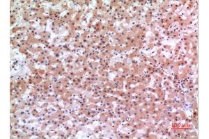 Immunohistochemistry (IHC) analysis of paraffin-embedded Human Liver, antibody was diluted at 1:100. (INHBE anticorps  (C-Term))