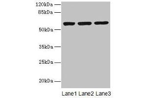 Western blot All lanes: MIER2 antibody at 4 μg/mL Lane 1: Jurkat whole cell lysate Lane 2: HepG2 whole cell lysate Lane 3: A549 whole cell lysate Secondary Goat polyclonal to rabbit IgG at 1/10000 dilution Predicted band size: 60 kDa Observed band size: 60 kDa