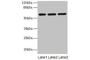 Western blot All lanes: MIER2 antibody at 4 μg/mL Lane 1: Jurkat whole cell lysate Lane 2: HepG2 whole cell lysate Lane 3: A549 whole cell lysate Secondary Goat polyclonal to rabbit IgG at 1/10000 dilution Predicted band size: 60 kDa Observed band size: 60 kDa (MIER2 anticorps  (AA 1-545))