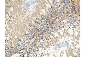 ABIN6256975 and ABIN6275033 at 1/100 staining Rat testis tissue by IHC-P. (C1QBP anticorps  (Internal Region))