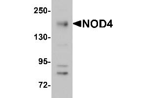 Western Blotting (WB) image for anti-NLR Family, CARD Domain Containing 5 (NLRC5) (N-Term) antibody (ABIN1031483) (NLRC5 anticorps  (N-Term))