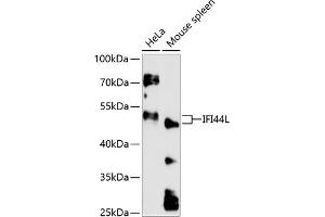 Western blot analysis of extracts of various cell lines, using IFI44L antibody (ABIN6130508, ABIN6142170, ABIN6142171 and ABIN6217125) at 1:3000 dilution. (IFI44L anticorps  (AA 1-200))