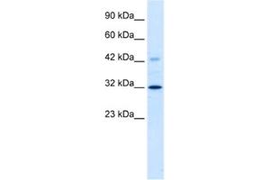 Western Blotting (WB) image for anti-Voltage-Dependent Anion Channel 1 (VDAC1) antibody (ABIN2461102) (VDAC1 anticorps)
