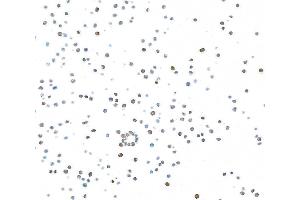 Immunocytochemistry (ICC) image for anti-Antigen Identified By Monoclonal Antibody Ki-67 (MKI67) (AA 1200-1250) antibody (ABIN7448915) (Recombinant Ki-67 anticorps  (AA 1200-1250))