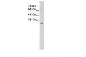 Image no. 1 for anti-Non-SMC Element 1 Homolog (NSMCE1) (AA 81-130) antibody (ABIN203534)