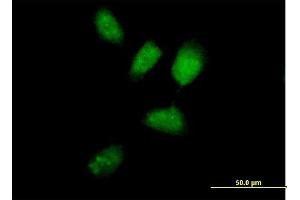 Immunofluorescence of purified MaxPab antibody to RNF8 on HeLa cell. (RNF8 anticorps  (AA 1-485))