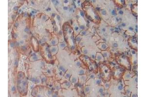 Detection of CDH16 in Mouse Kidney Tissue using Polyclonal Antibody to Cadherin 16 (CDH16)