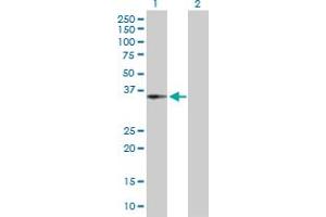 Western Blot analysis of CENPH expression in transfected 293T cell line by CENPH MaxPab polyclonal antibody. (CENPH anticorps  (AA 1-247))