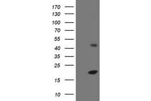 Image no. 1 for anti-Eukaryotic Translation Initiation Factor 5A2 (EIF5A2) antibody (ABIN1497998) (EIF5A2 anticorps)
