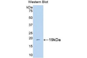 Detection of Recombinant CYPA, Human using Polyclonal Antibody to Cyclophilin A (CYPA) (PPIA anticorps  (AA 2-165))