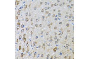 Immunohistochemistry of paraffin-embedded rat brain using BTD antibody at dilution of 1:100 (40x lens). (BTD anticorps)