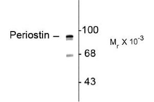 Image no. 1 for anti-Periostin (POSTN) (C-Term) antibody (ABIN372700) (Periostin anticorps  (C-Term))