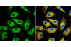 ICC/IF Image MX1 antibody [N2C2], Internal detects MX1 protein at cytoplasm by immunofluorescent analysis. (MX1 anticorps  (Internal Region))