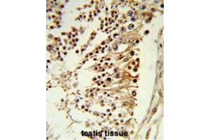 Formalin-fixed and paraffin-embedded human testis tissue reacted with CENPH Antibody (Center), which was peroxidase-conjugated to the secondary antibody, followed by DAB staining.