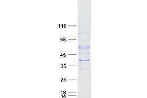 Validation with Western Blot