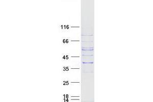 Validation with Western Blot (SLC25A16 Protein (Myc-DYKDDDDK Tag))