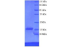 SDS-PAGE (SDS) image for Ribonucleoprotein, PTB-Binding 2 (RAVER2) (AA 1-140), (partial) protein (His tag) (ABIN5714484)
