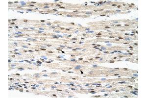 HNRPDL antibody was used for immunohistochemistry at a concentration of 4-8 ug/ml to stain Skeletal muscle cells (arrows) in Human Muscle. (HNRPDL anticorps  (Middle Region))