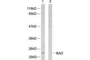 Western blot analysis of extracts from 293 cells, treated with Forskolin, using BAD (Ab-112) Antibody. (BAD anticorps  (AA 78-127))