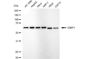 Western blotting analysis using G3BP1 antibody (ABIN7798816).