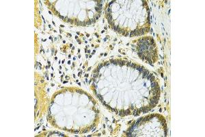 Immunohistochemistry of paraffin-embedded human colon using SLC25A1 antibody.
