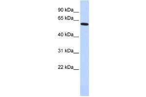 Western Blotting (WB) image for anti-Eyes Absent Homolog 1 (EYA1) antibody (ABIN2457953) (EYA1 anticorps)