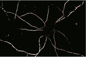 Immunofluorescence staining of rat neurons. (Striatin anticorps  (AA 450-600))