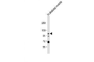 Western Blot at 1:1000 dilution + human skeletal muscle lysate Lysates/proteins at 20 ug per lane. (KCNQ5 anticorps  (C-Term))