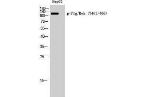 Western Blotting (WB) image for anti-FGFR1, FGFR2 (pTyr463), (pTyr466) antibody (ABIN3182346) (FGFR1/FGFR2 anticorps  (pTyr463, pTyr466))