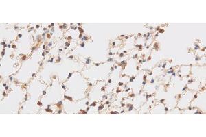 Immunohistochemistry of paraffin-embedded Mouse brain using TRIP4 Polyclonal Antibody at dilution of 1:50 (TRIP4 anticorps)