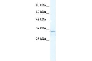 TRPM3 antibody used at 2. (TRPM3 anticorps  (N-Term))