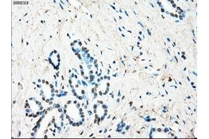 Immunohistochemical staining of paraffin-embedded Ovary tissue using anti-LTA4H mouse monoclonal antibody. (LTA4H anticorps)