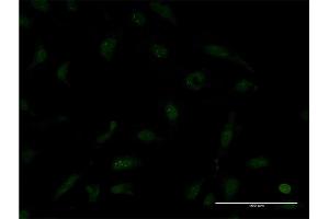 Immunofluorescence of monoclonal antibody to TTF2 on HeLa cell.