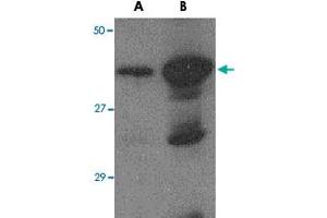 Western blot analysis of (A) 5 ng and (B) 25 ng of recombinant HA1 with Avian Influenza Hemagglutinin 2 polyclonal antibody  at 1 ug/mL . (Hemagglutinin anticorps  (N-Term))