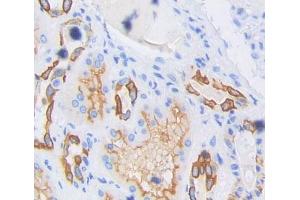IHC-P analysis of Human Tissue, with DAB staining. (Sortilin 1 anticorps  (AA 50-320))
