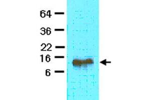 The extract of mouse heart (40 ug) was resolved by SDS-PAGE and probed with FABP4 monoclonal antibody, clone 3F4  (1:500). (FABP4 anticorps  (AA 1-132))