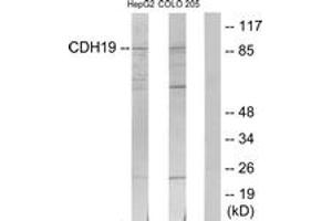 Western blot analysis of extracts from HepG2/COLO205 cells, using CDH19 Antibody. (CDH19 anticorps  (AA 371-420))