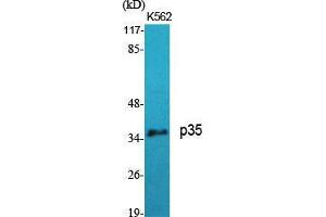 Western Blot (WB) analysis of specific cells using p35 Polyclonal Antibody. (P35 (N-Term) anticorps)