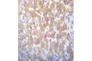 Formalin fixed and paraffin embedded human liver tissue reacted with FAST kinase (C-term) Antibody (C-term) Cat. (FASTK anticorps  (C-Term))