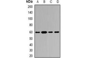 Western blot analysis of Tyrosyl-tRNA Synthetase expression in Hela (A), SKOV3 (B), mouse brain (C), rat brain (D) whole cell lysates. (YARS anticorps)