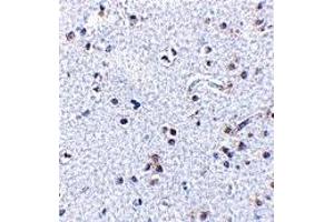Immunohistochemistry (IHC) image for anti-Thymic Stromal Lymphopoietin (TSLP) (C-Term) antibody (ABIN1030782) (Thymic Stromal Lymphopoietin anticorps  (C-Term))