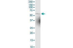 ZNF238 MaxPab rabbit polyclonal antibody. (ZNF238 anticorps  (AA 1-522))