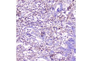 IHC analysis of ADA using anti-ADA antibody (ABIN6719272). (ADA anticorps  (AA 135-363))