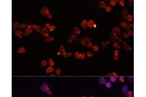 Immunofluorescence analysis of HeLa cells using SLC25A4 Polyclonal Antibody at dilution of 1:100 (40x lens). (SLC25A4 anticorps)