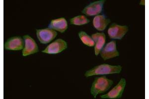 ABIN6266313 and ABIN6277430 staining Hela cells by IF/ICC. (RAD52 anticorps  (Internal Region))