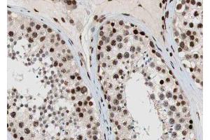 ABIN6269384 at 1/100 staining human testis tissue sections by IHC-P.