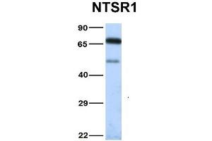 Host:  Rabbit  Target Name:  NTSR1  Sample Type:  Human Fetal Heart  Antibody Dilution:  1. (NTSR1 anticorps  (N-Term))